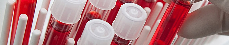 Биохимический анализ крови в городе Красногорск
